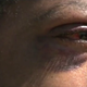 Adrian Williams shows close-up image of eye injury suffered during what authorities say was a bias attack.